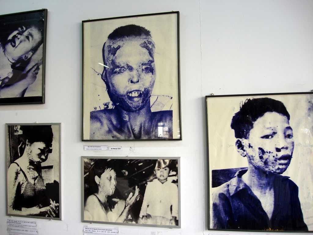 Pictures of those affected by chemical weapons in Vietnam.